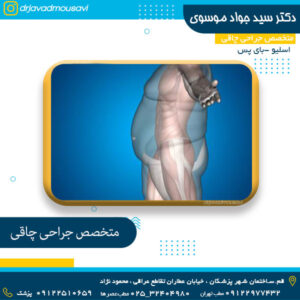 متخصص جراحی چاقی - دکتر موسوی