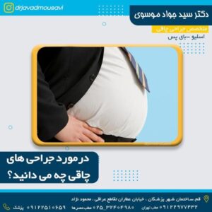 جراحی چاقی - دکتر موسوی