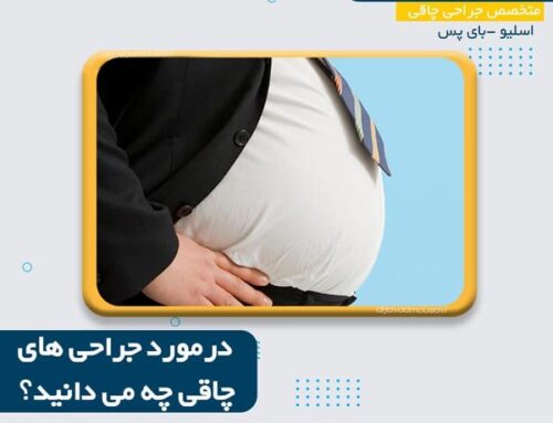 جراحی چاقی با دکتر جواد موسوی