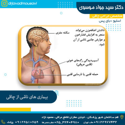 بیماری های ناشی از چاقی - دکتر جواد موسوی