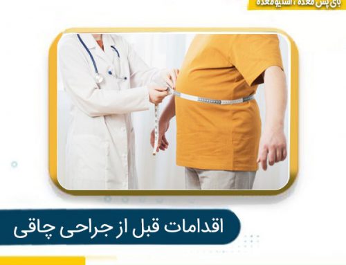 اقدامات قبل از جراحی چاقی