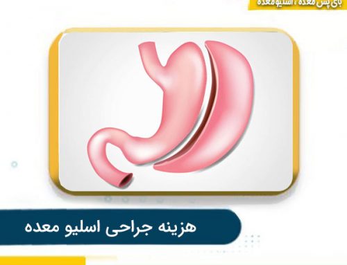 هزینه اسلیو معده (جراحی معده برای لاغری) سال 1405 در قم