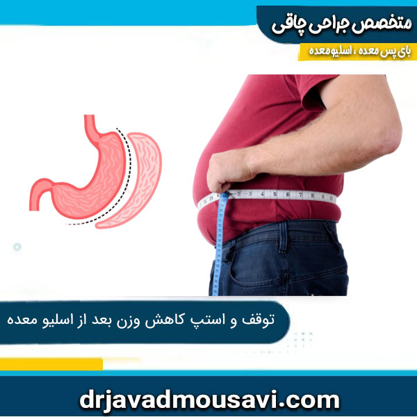 دلایل توقف و استپ کاهش وزن بعد از اسلیو معده