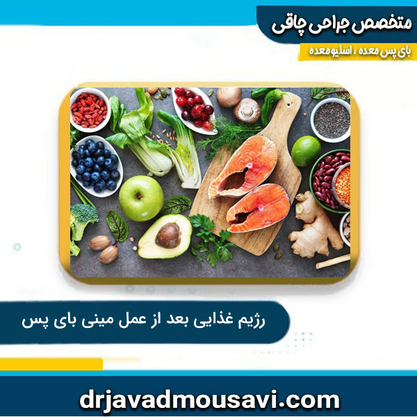 رژِم غذایی بعد از عمل مینی بای پس معده